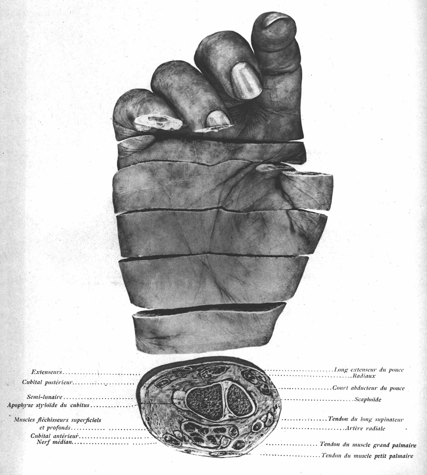 Cross-sectioned right hand.
